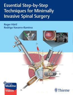 Ten Step Techniques for Minimally Invasive Spine Surgery
