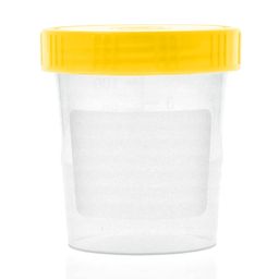 Urinbecher/Probenbecher mit Schraubdeckel - 125ml Fassungsvermögen, Auslaufsicher, Beschriftbar