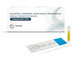 Chlamydien-, Gonorrhoe-, Trichomonaden- & Mykoplasmen-Test (Mann) - Urintest - The Tester