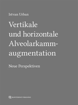 Vertikale und horizontale Alveolarkammaugmentation Neue Perspektiven