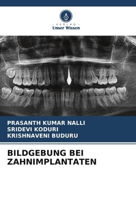 BILDGEBUNG BEI ZAHNIMPLANTATEN DE