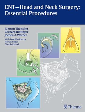 ENT Head and Neck Surgery: Essential Procedures