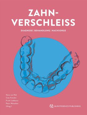 Zahnverschleiß Diagnose | Behandlung | Nachsorge