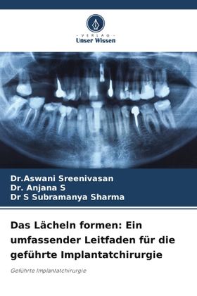 Das Lächeln formen: Ein umfassender Leitfaden für die geführte Implantatchirurgie Geführte Implan...