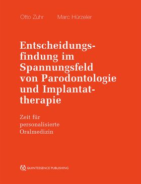 Entscheidungsfindung im Spannungsfeld von Parodontologie und Implantattherapie, 3 Teile Zeit für ...