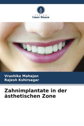 Zahnimplantate in der ästhetischen Zone DE