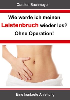 Wie werde ich meinen Leistenbruch wieder los?  Ohne Operation!