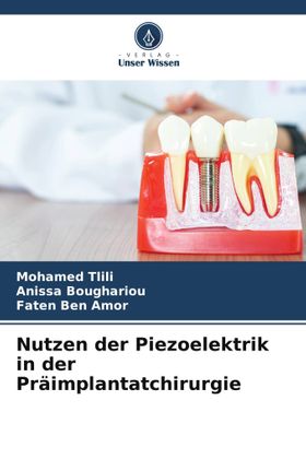 Nutzen der Piezoelektrik in der Präimplantatchirurgie DE