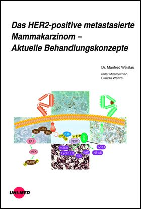 Das HER2-positive metastasierte Mammakarzinom – Aktuelle Behandlungskonzepte