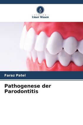 Pathogenese der Parodontitis DE