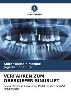 VERFAHREN ZUM OBERKIEFER-SINUSLIFT Eine umfassende Analyse der Verfahren zum Sinuslift im Oberkie...