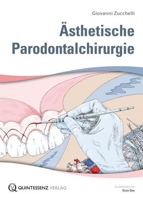 Ästhetische Parodontalchirurgie, Buch + Lehrtafeln 2 Bde in Kassette