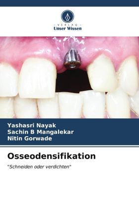 Osseodensifikation "Schneiden oder verdichten"