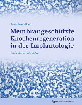 Membrangeschützte Knochenregeneration in der Implantologie Seit 35 Jahren Fortschritt und neue An...