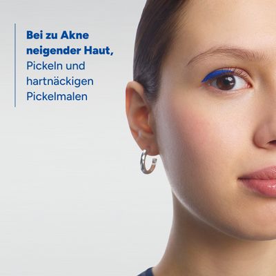 Glytone Akne-Flecken-Creme – Getönt, Mit 8% Schwefel & 2% Resorcin – ölfrei, Nicht Komedogen – 30 Ml