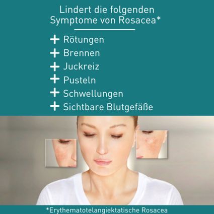 Sebomax Creme 30 Ml – Bei Rötungen & Schuppen In Der T-Zone, Mit Schwefel & Crotamiton, Für Seborrhoische Dermatitis