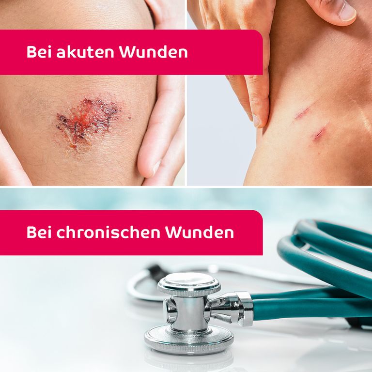 octenisept® WundDesinfektionsSpray 50 ml Shop Apotheke