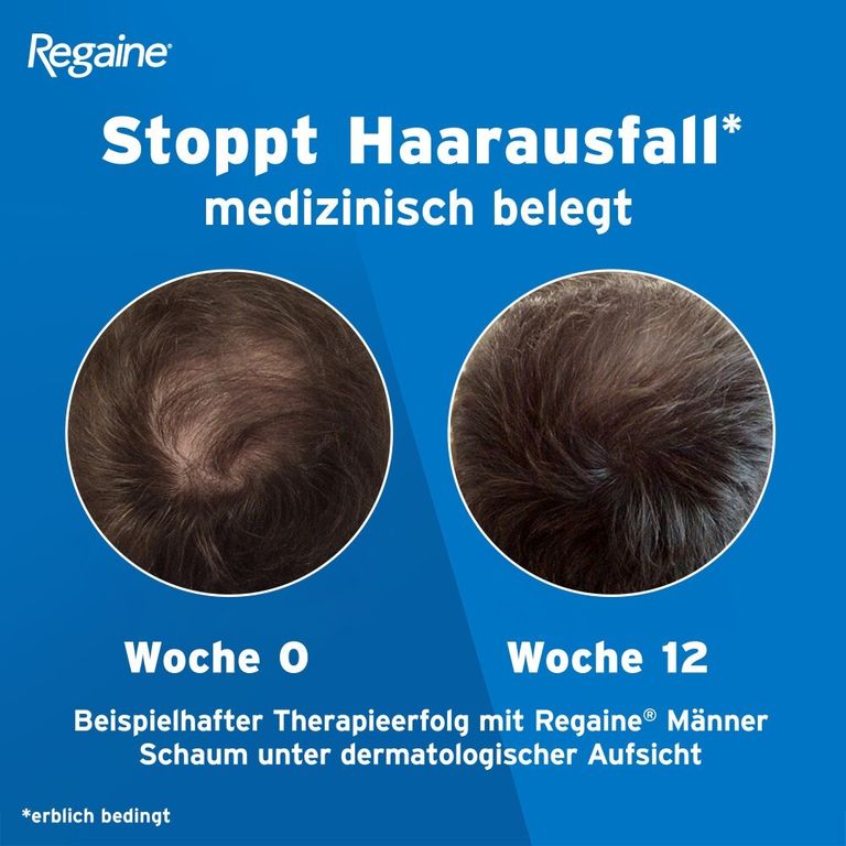Regaine® Männer Schaum 6 MonatsVorrat 6x60 g Shop Apotheke