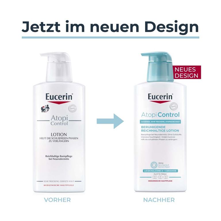 Eucerin AtopiControl Lotion beruhigt die Haut bei Neurodermitis