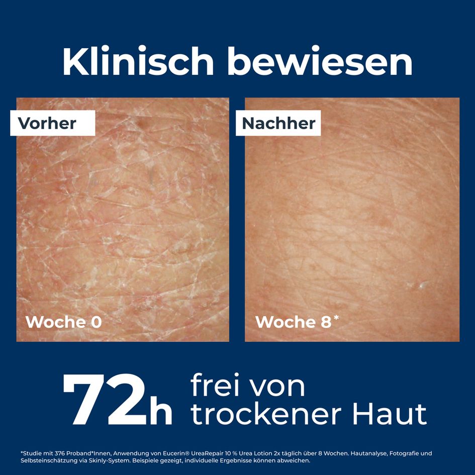Eucerin® UreaRepair PLUS Lotion 10 reichhaltige Körperlotion für