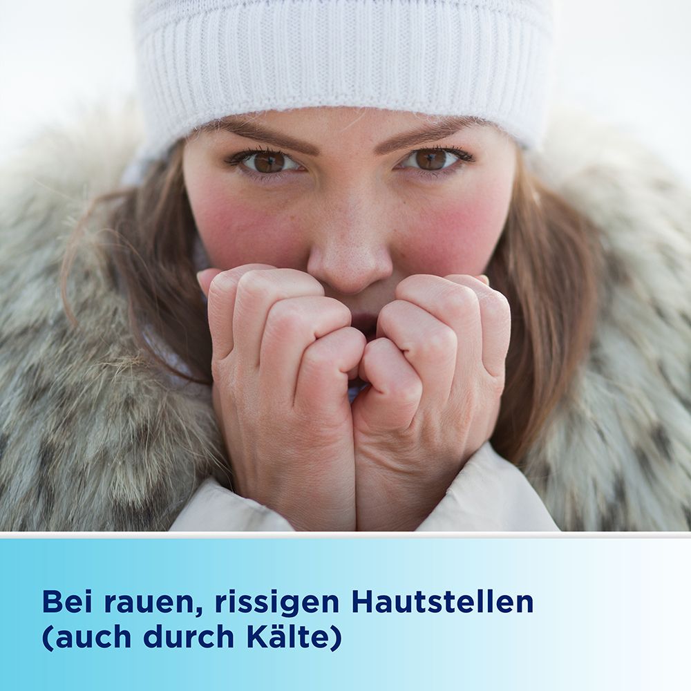 Frau mit geröteten Wangen hält Hände vor Mund. Text: Bei rauen, rissigen Hautstellen (auch durch Kälte).