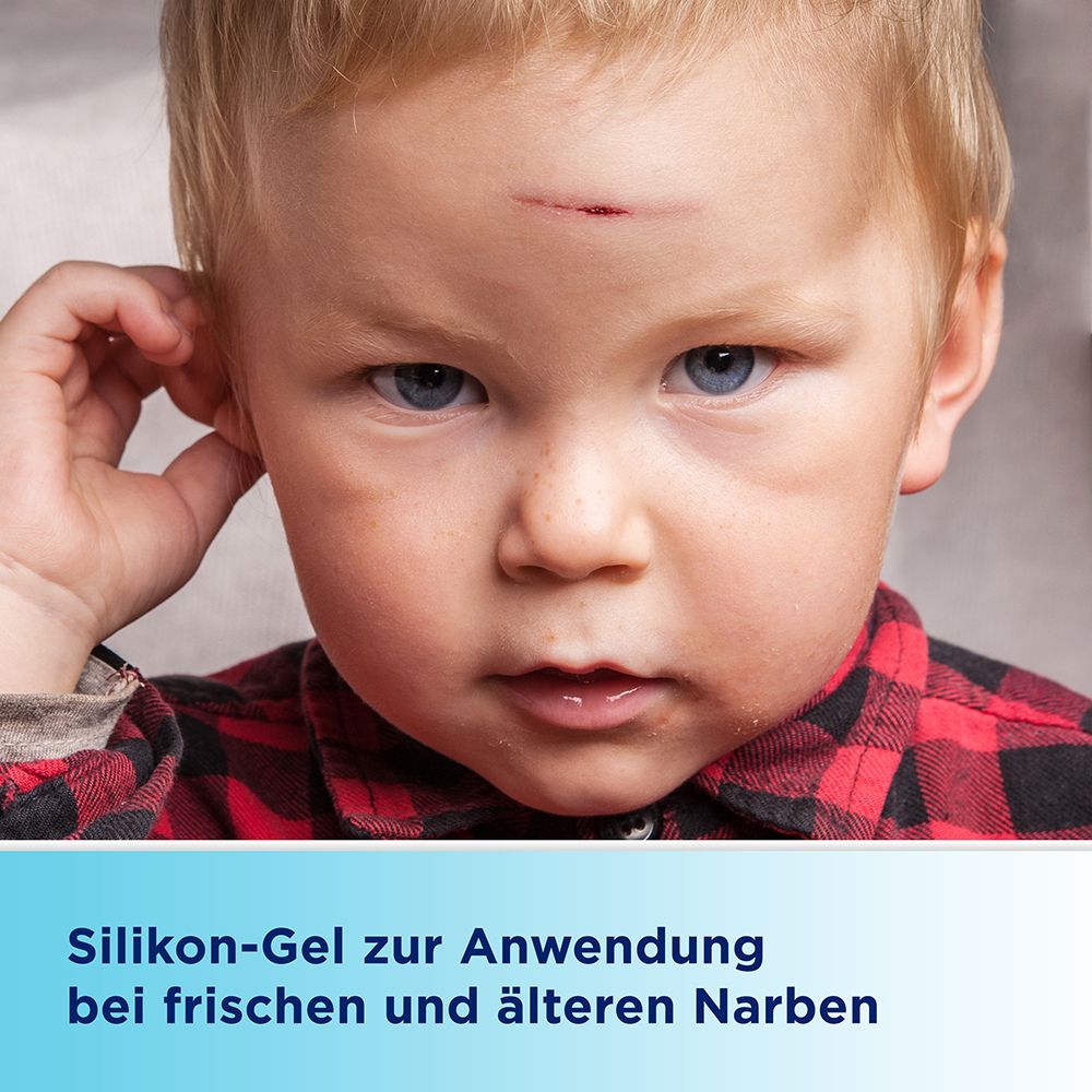 Kind mit roter Narbe auf der Stirn. Text: Silikon-Gel zur Anwendung bei frischen und älteren Narben.