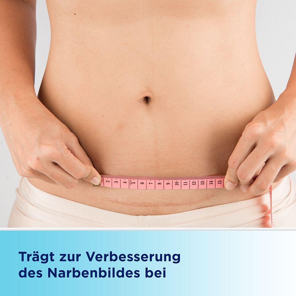 Bauch einer Person mit Narbe. Text: Trägt zur Verbesserung des Narbenbildes bei.