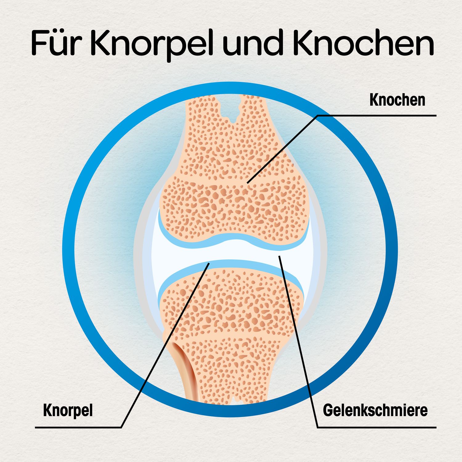Grafische Darstellung eines Kniegelenks. Beschriftungen: Knorpel, Knochen, Gelenkschmiere.