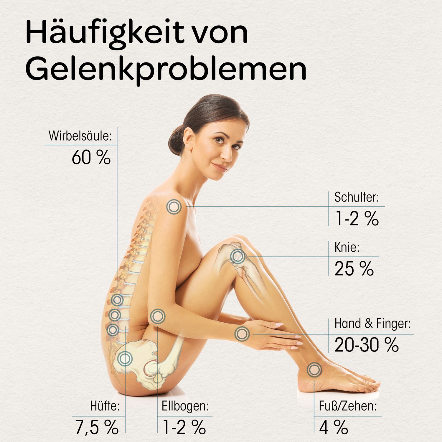 Grafik mit Häufigkeit von Gelenkproblemen. Frau mit Markierungen an Gelenken. Prozentangaben.