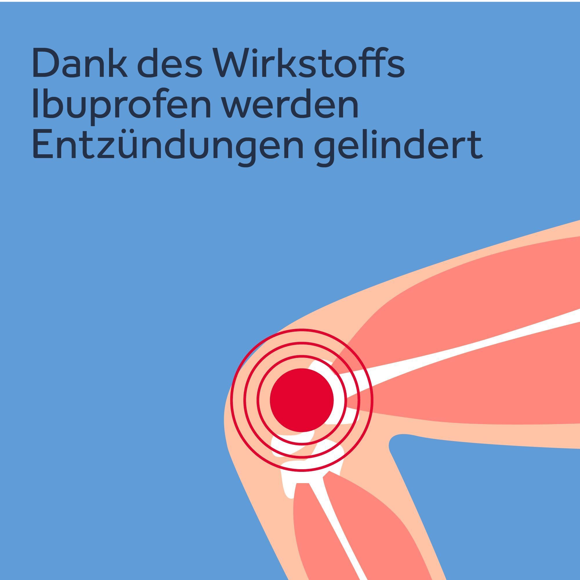 Grafik eines Knies. Rote Kreise zeigen Entzündungen, Text erklärt die Wirkung von Ibuprofen.