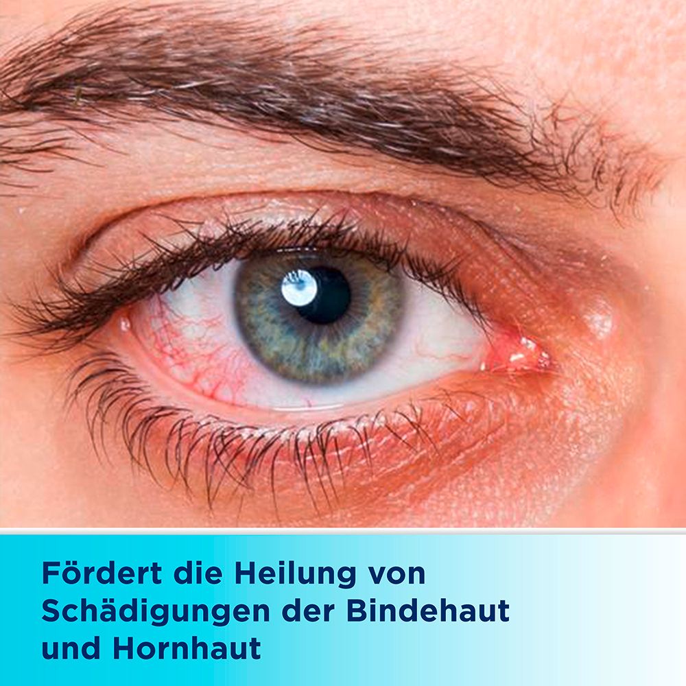 Auge mit geröteter Bindehaut. Text: Fördert die Heilung von Schädigungen der Bindehaut und Hornhaut.
