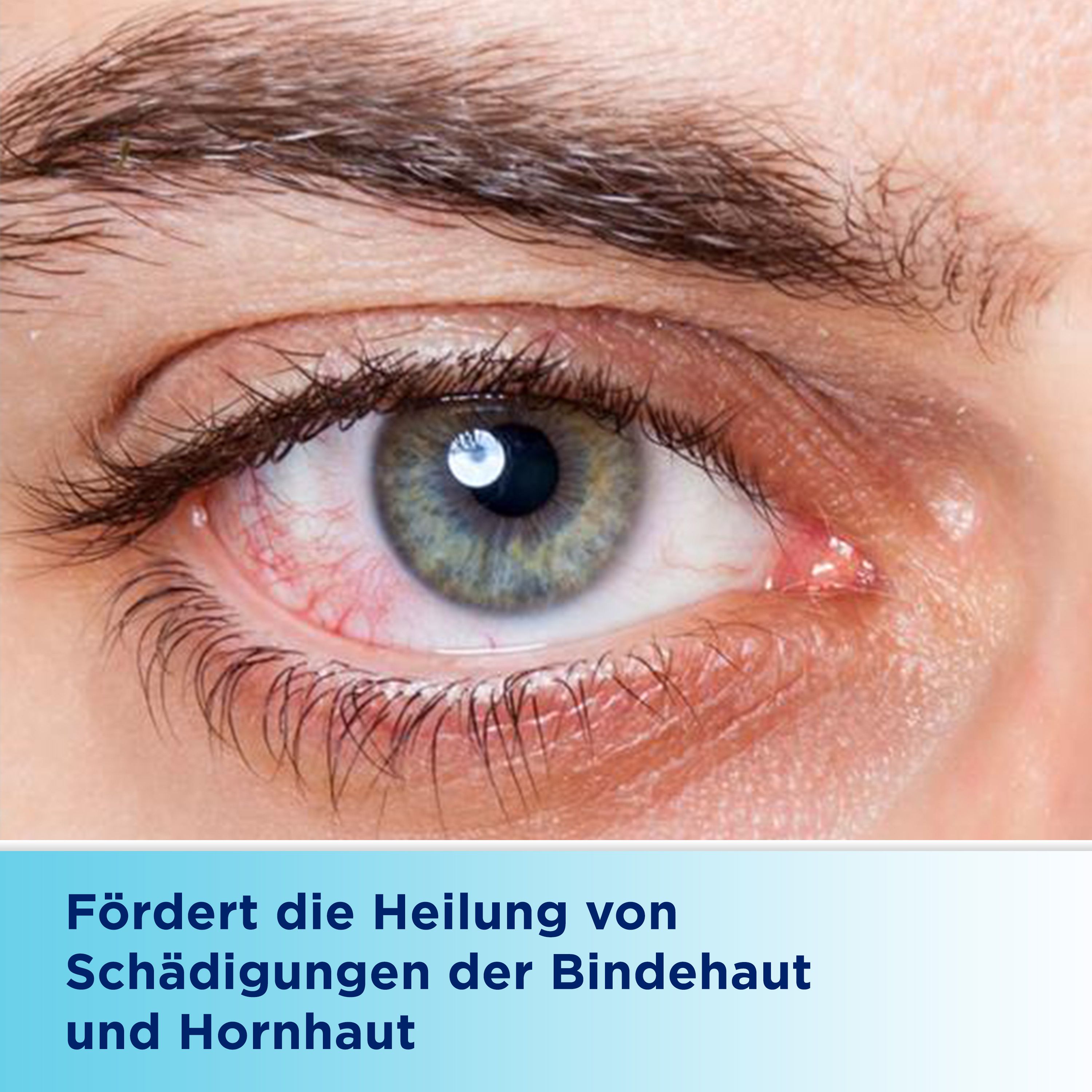 Nahaufnahme eines Auges mit Rötung. Text: Fördert die Heilung von Schädigungen der Bindehaut und Hornhaut.