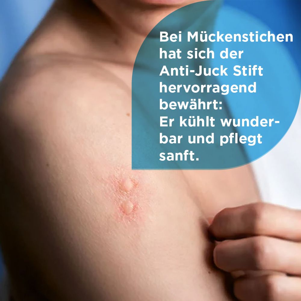 Mann mit Insektenstichen am Arm. Text: Anti-Juck Stift hat sich bewährt. Kühlt und pflegt sanft.