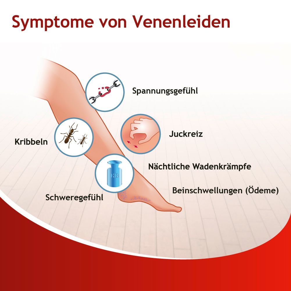 Illustration von Symptomen von Venenleiden. Kreise zeigen Krampfadern, Schwellungen, Juckreiz, Schweregefühl und Kribbeln.