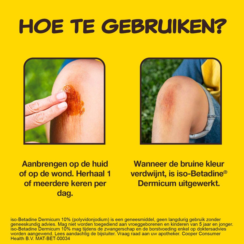 Gele achtergrond met tekst: Hoe te gebruiken? Twee afbeeldingen: wonde met product, been. Tekst: Toepassing.