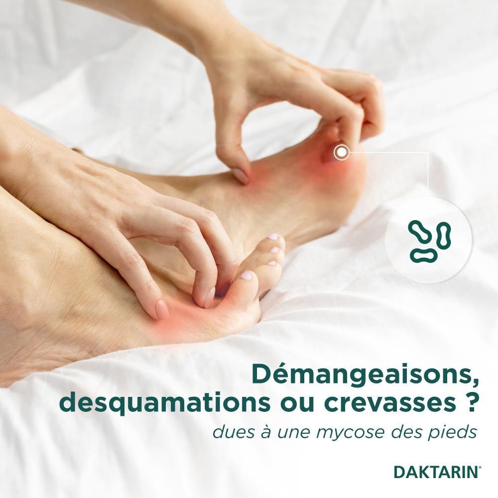 Pied avec éruption cutanée. Texte : Démangeaisons, squames ou crevasses ? Daktarin.