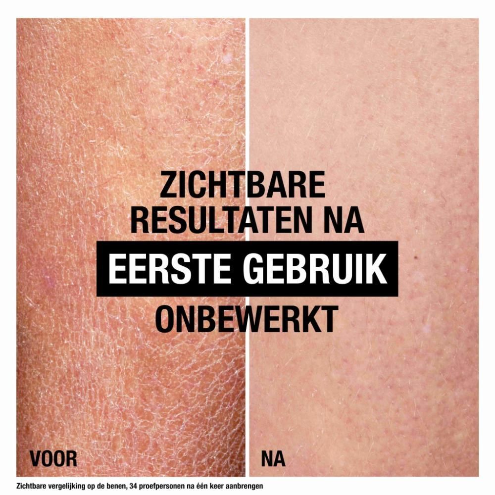 Vergelijking van de huid voor en na gebruik. Tekst: Zichtbare resultaten na eerste gebruik. Niet geretoucheerd.