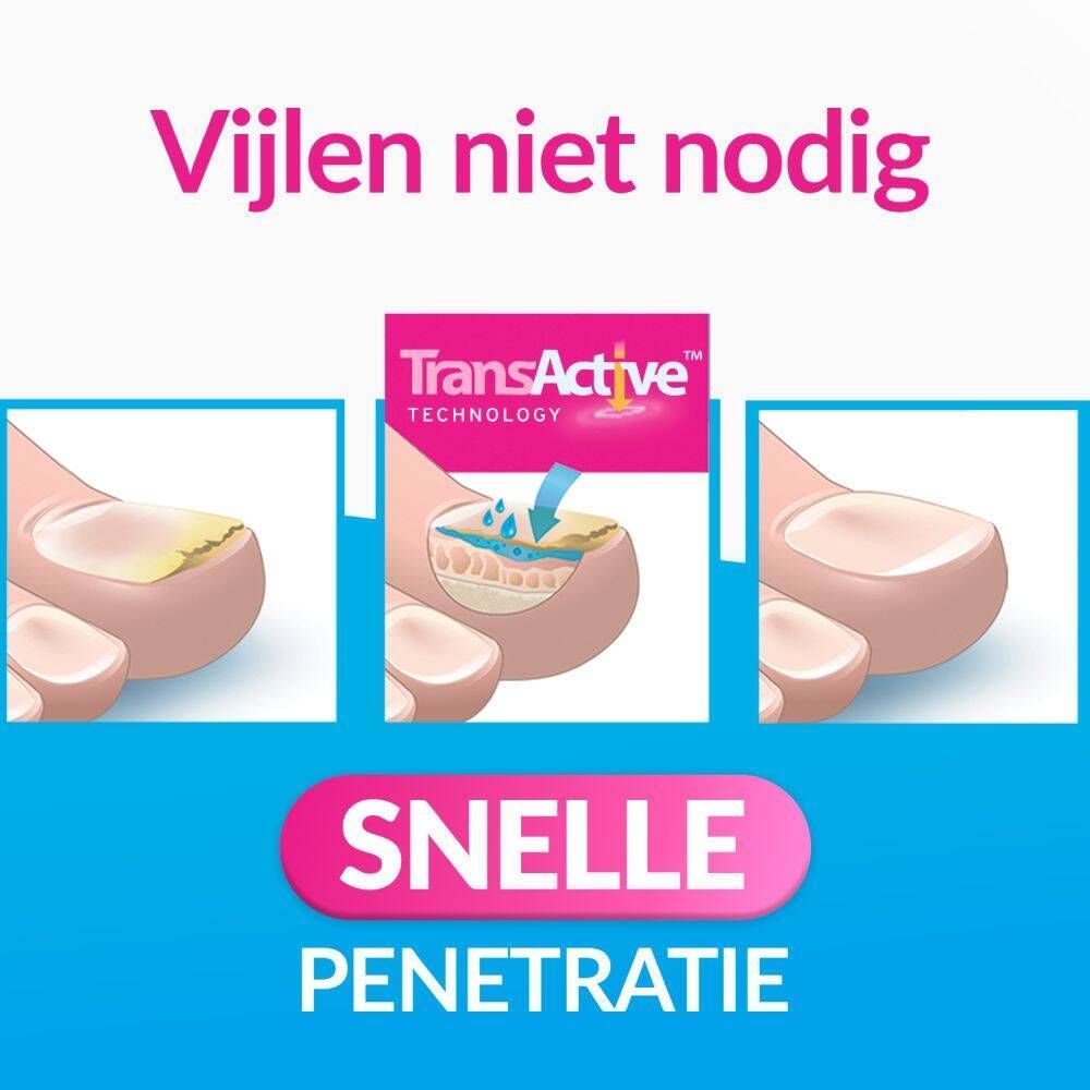 Vrouw met blauwe schoen. Voeten met blauwe schoen. Tekst: Rend les ongles sains et beaux.