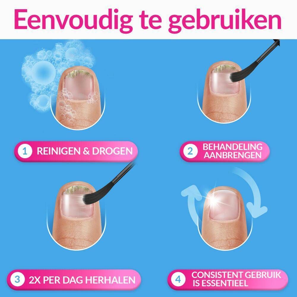 Applicator op een teennagel. Tekst: Facile à utiliser. Cliniquement prouvé.