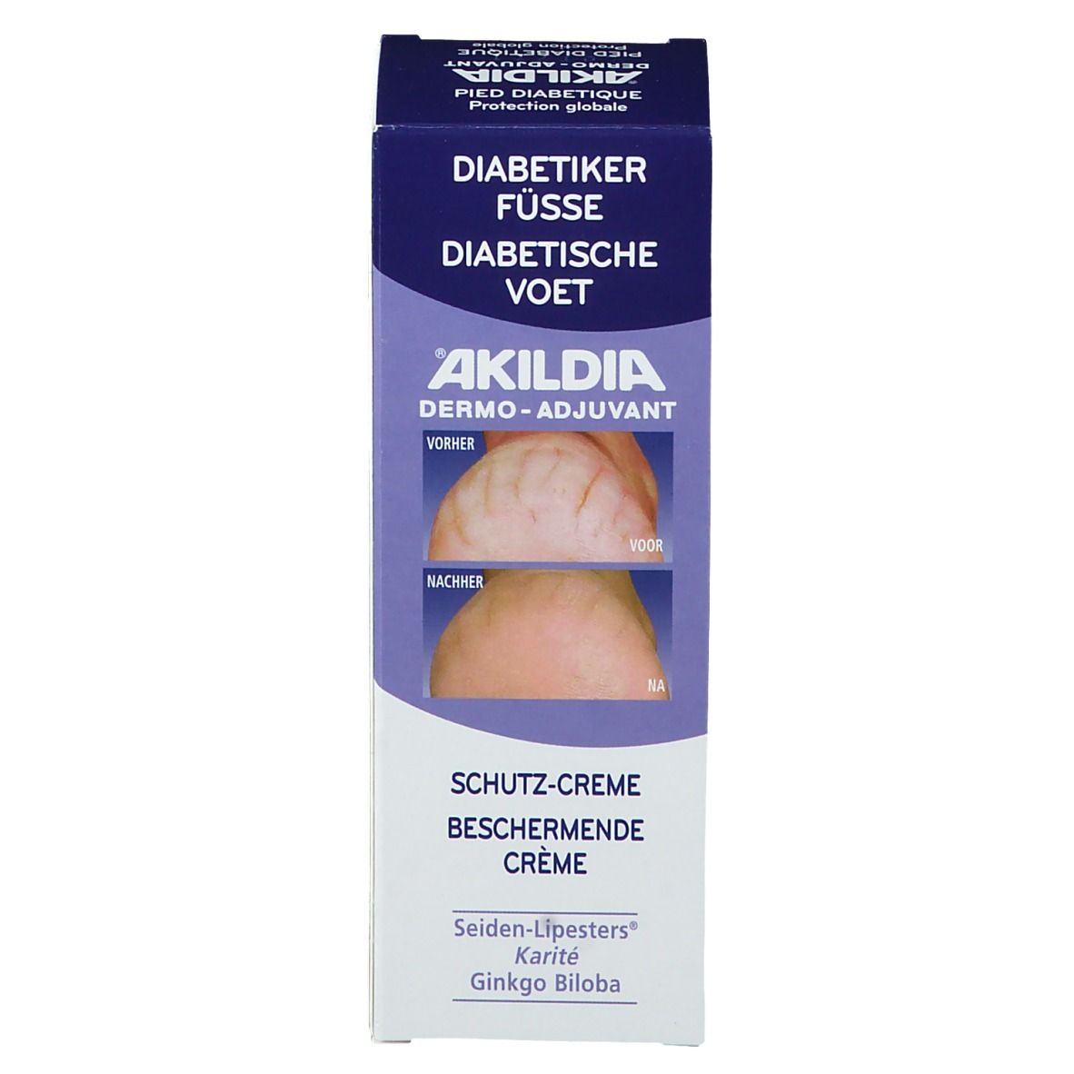 Emballage de la crème AKILDIA. Texte: Pieds diabétiques, Schutz-Creme, Avant/Après, Seiden-Lipester, Karité, Ginkgo Biloba.