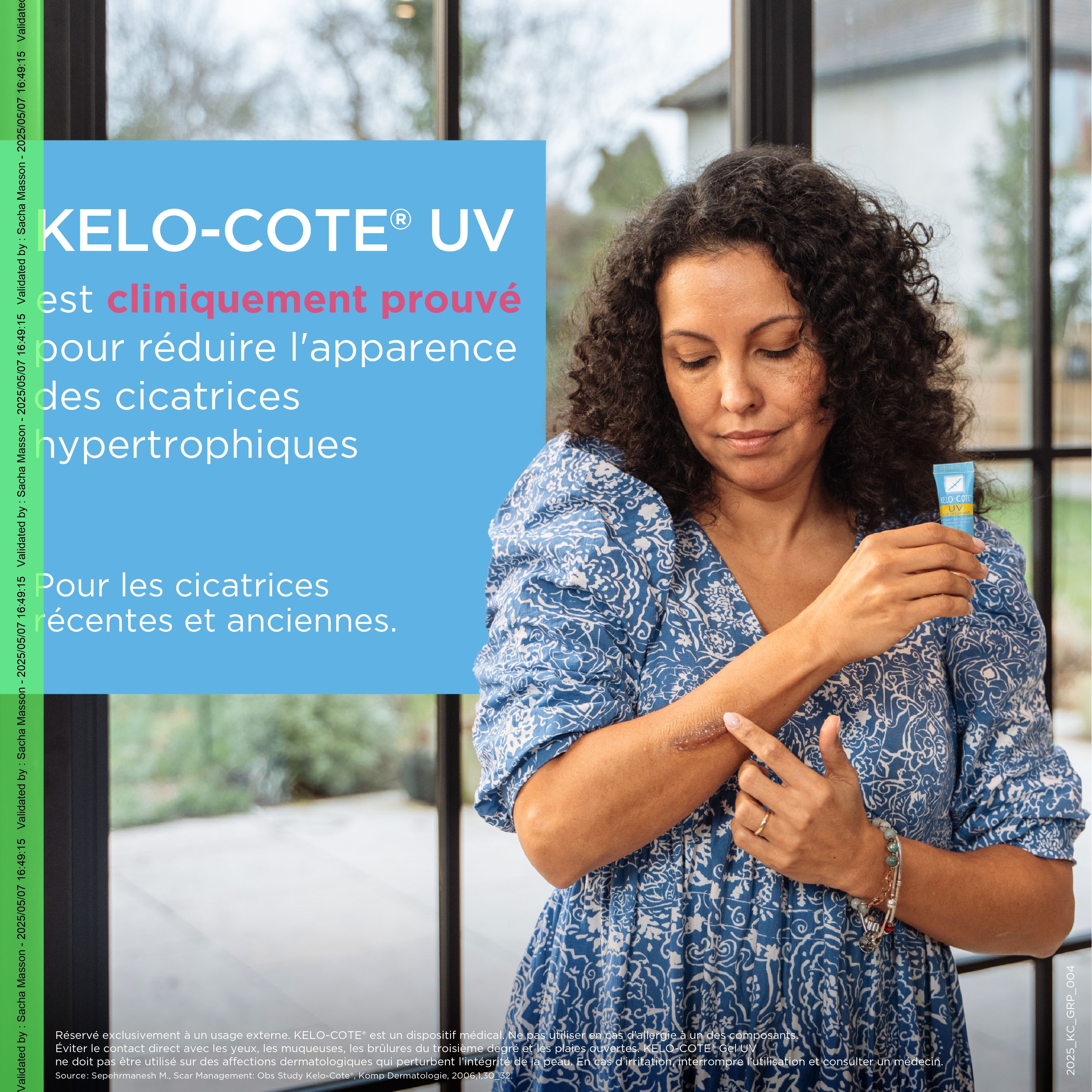 Femme avec bras. Le gel Kelo-Cote UV réduit les cicatrices. Pour cicatrices anciennes et récentes.