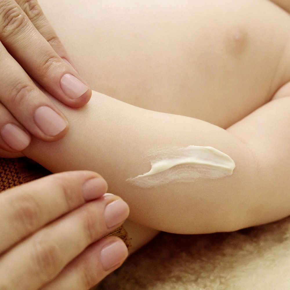 Mains appliquant de la crème sur le bras d'un bébé. La crème est visible.