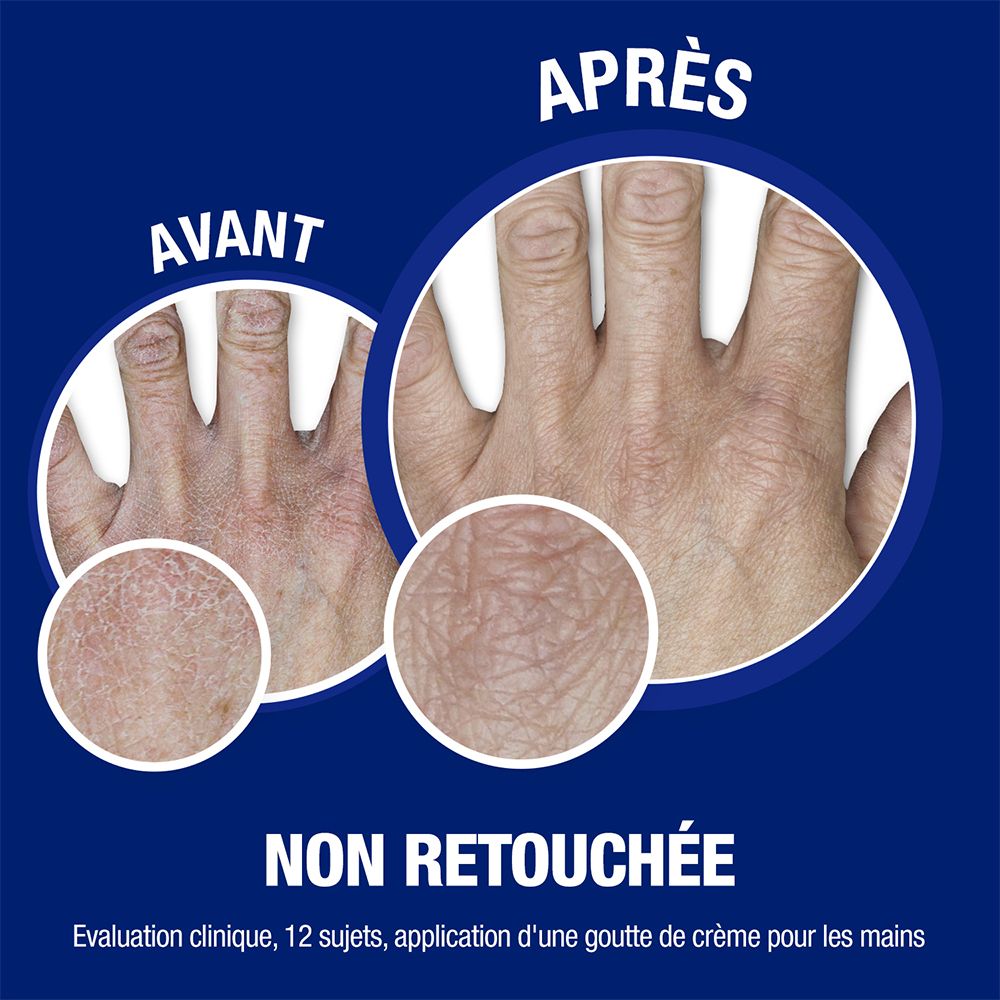 Comparaison des mains avant et après application. Texte: Avant, Après, Non retouchée. Évaluation clinique.