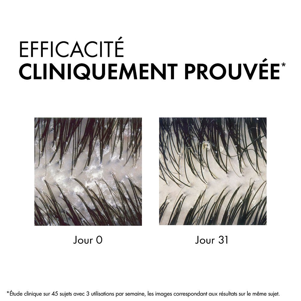 Due immagini del cuoio capelluto prima e dopo. Testo: Efficacia clinicamente provata.