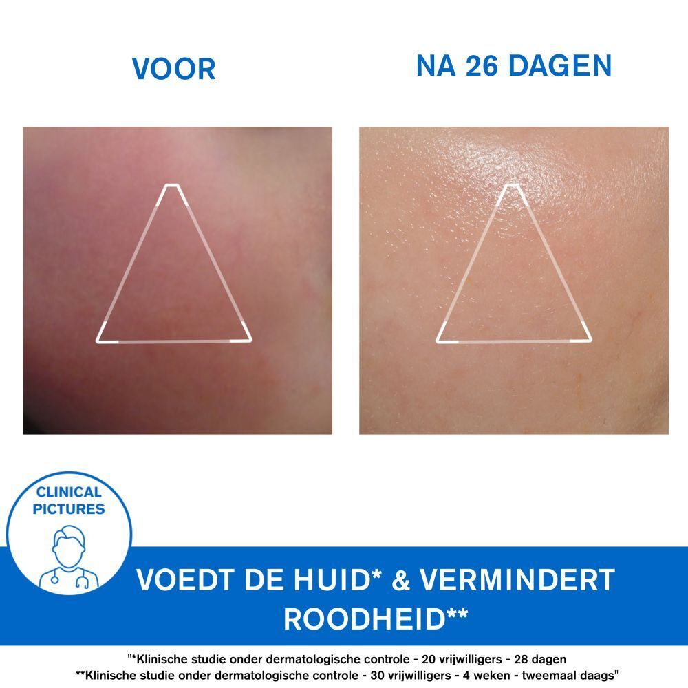 Witte tube met blauwe tekst. Uriage, Xémose Crème Visage, Face Cream. Voor droge huid.