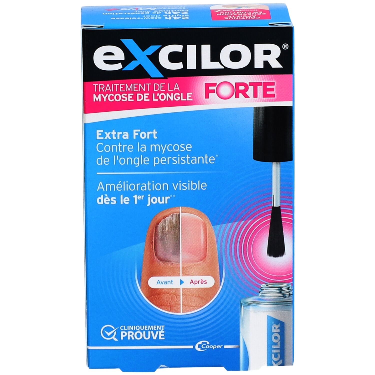Produktverpackung. Exclior Forte. Nagelpilzbehandlung. Flasche mit Pinsel. Vorher-Nachher-Nagelansicht.