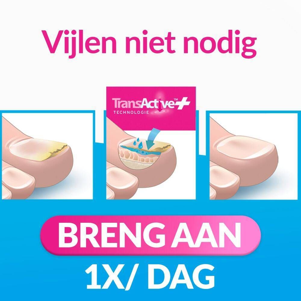Productverpakking. Exclior Forte. Schimmelnagel behandeling. Fles met borstel. Voor-na nagelweergave.