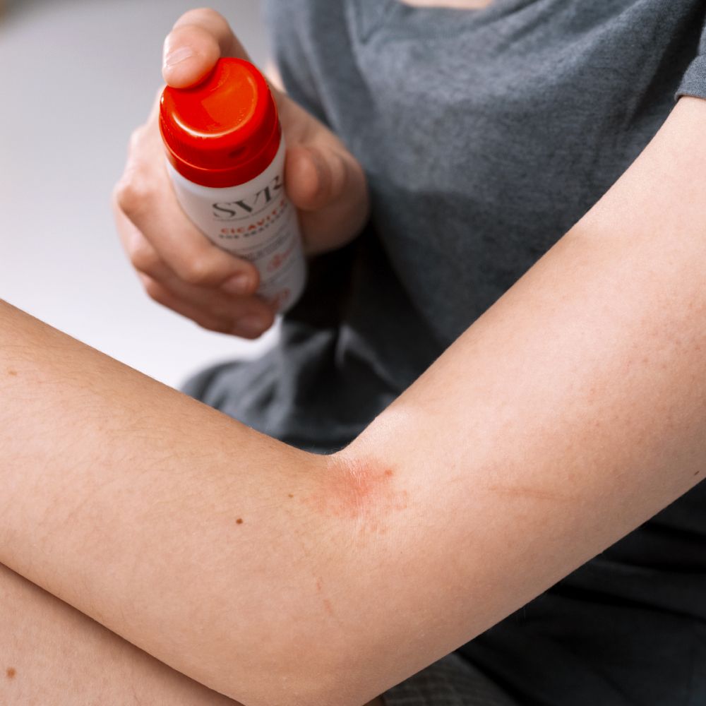 SVR CICAVIT+ SOS Grattage spray. Witte fles met rode spuitkop. Tekst: Anti-irritation complex 15%.