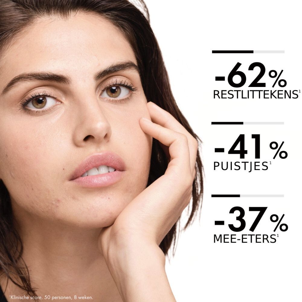 Gezicht van een vrouw. Tekst: -62% restlittekens. -41% puistjes. -37% mee-eters.