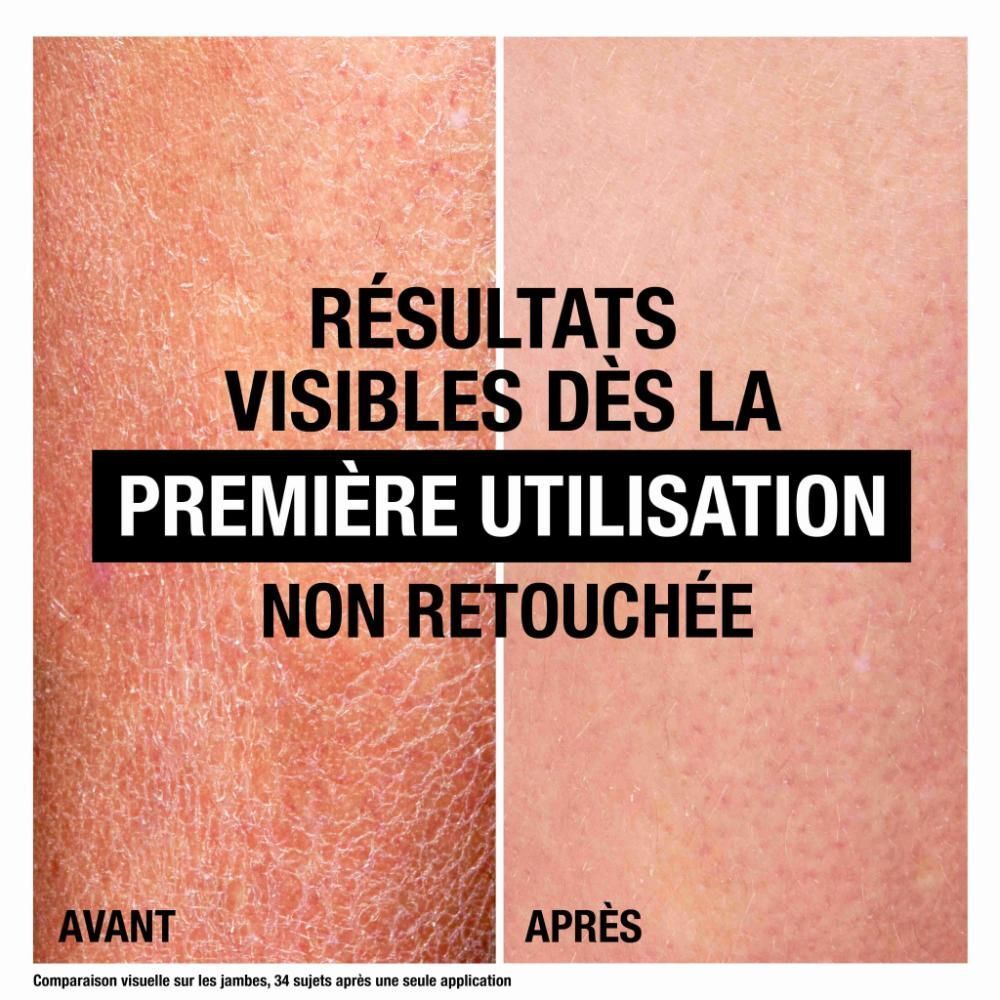 Comparaison avant/après. Amélioration visible de la peau sèche après utilisation.